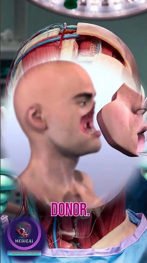 The Miracle of Science: How Facial Transplants Work! 🏥