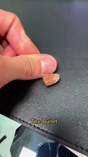 Bullet Removal: Surgery and Techniques