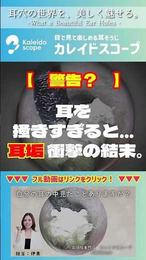 【警告？】耳を掻きすぎると…耳垢衝撃の結末。