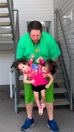 335K views · 3.2K reactions | Conjoined twins Callie and Carter were born attached by their pelvis area - sharing all organs from the belly button down and having a single leg each 懶 #fbreels #conjoinedtwins #twins #viralreels #myextraordinaryfamily #inspiration #family #reels | My Extraordinary Family | Facebook