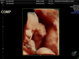 687K views · 4.5K reactions | HD Live Ultrasound is even better than we thought. Take a look at this amazing 4D Ultrasound Video. Breathtaking. May take a little time to adjust to where the baby is located. This is a baby at 28 weeks by ultrasound at our office last week. Minnesota Women's Care. www.mnwcare.com | Minnesota Women's Care | Facebook