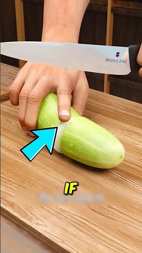 What Not To Do If You Cut Off Your Finger 😨 #FirstAidTips #MedicalFacts #EmergencyHelp