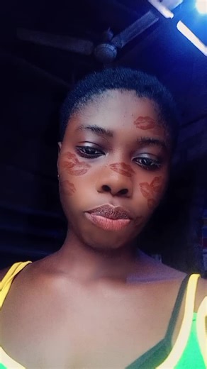 Epiderm baby💯💞💫💫 (@epiderm.baby)’s videos with original sound - The_rrick🤟