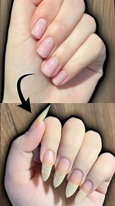 Grow Nails just in 3 Days [ Faster Growth ] | How to Grow Nails Fast || Faster Nail Growth Remedy ||