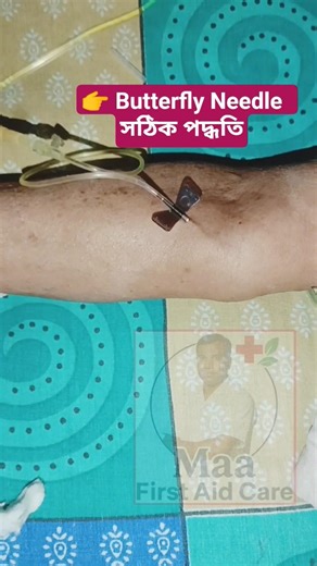 বাটারফ্লাই নিডেল সঠিকভাবে কীভাবে লাগাতে হয় | Butterfly Needle Procedure in Bengali#nursing #shorts