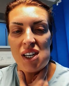 This woman went to Turkey to get new teeth, and massively regretted it. It ruined her life... | LADbible