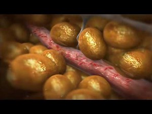 Cellulite 3D medical animation - VelaShape by Syneron,video produced by Virtual Point