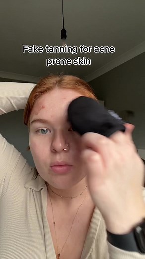 The Ultimate Guide to Fake Tanning for Acne Prone Skin