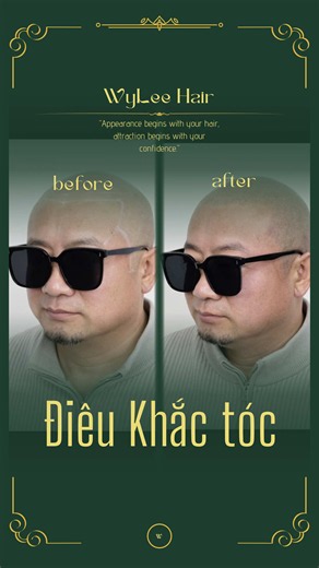 Nghệ Thật Là Ánh Trăng Lừa Dối.#xămtóc #rụngtóc #tócgiả #quốclê #wylee
