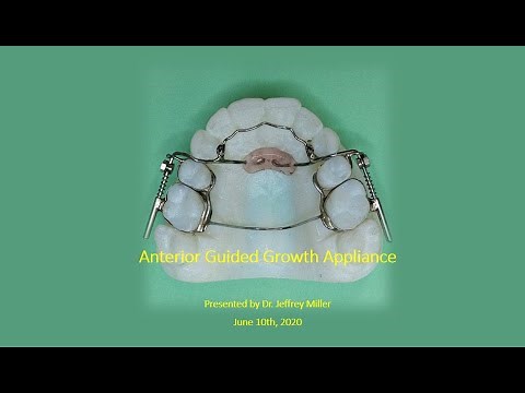 Anterior Guided Growth Appliance, AGGA, Is it Safe? No!