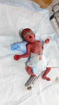 Preetaram Baby | + NICU Care | 20 Weeks | 0.5kg Weight | condition cortical 🍼💖 #maternityservices