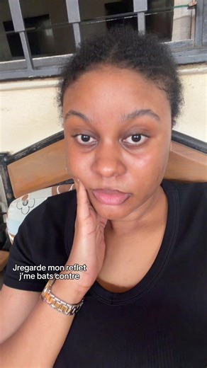 #CapCut #sassyskin #viral #trendviral #fyp