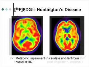Advances in Alzheimer's Disease: Imaging and Biomarker Research