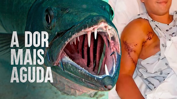 Como sobreviver a um ataque de barracuda
