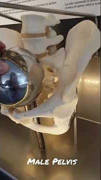 Gynecoid vs Android Pelvis