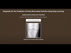 Rheumatoid Arthritis Detection Using Deep Learning | Machine Learning | Python | College Project