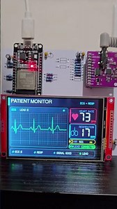 DIY ECG Monitor using ADS1292R, ESP32, LCD Display