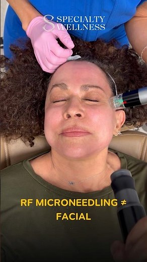 RF Microneedling is one of the most effective treatments for improving skin texture.