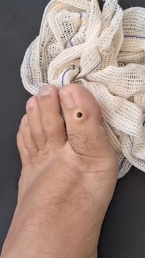 3K views · 24 reactions |  You won't believe what came out of this one... #pimplepop #satisfying | Page 1 | Facebook