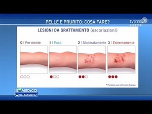 Skin and itching: what to do?