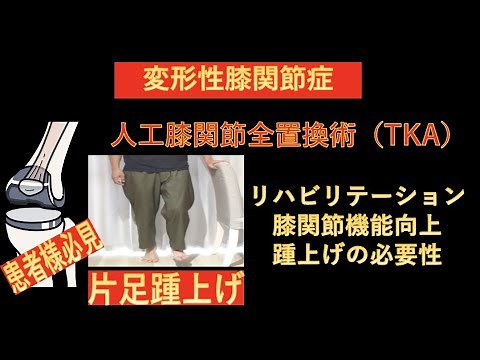 人工膝関節全置換術（TKA）術後のリハビリテーション-さらなる膝関節機能向上を図るための、片足踵上げの実践方法-