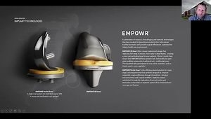 Intra-Operative Solutions for Outpatient TJA - Tools, Implants, and Protocols