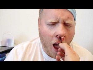 Nose Packing removal