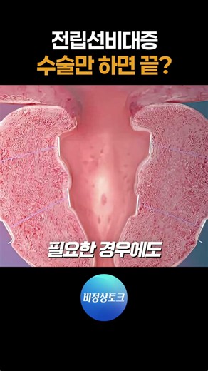 Is Surgery All It Takes for Benign Prostatic Hyperplasia?