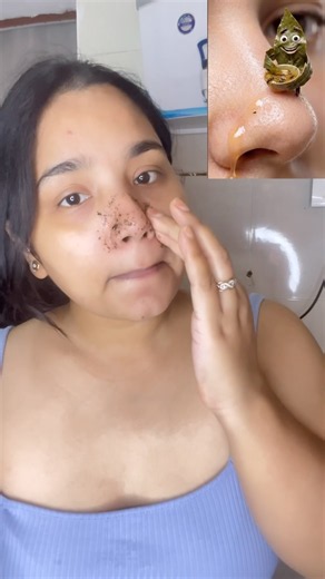 BLACKHEAD & WHITEHEAD REMOVAL AT HOME ✨ | Easy DIY Deep Cleansing Facial for Clear & Smooth Skin✨