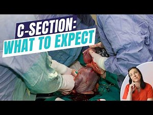 C-Section 101: Everything you need to know to prepare