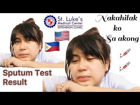 CR1 VISA SPUTUM TEST RESULT AT St. Luke's Extension Clinic 2021 | My Medical experience during Covid