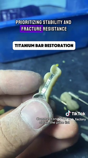 Titanium Bar Restoration for Dental Labs