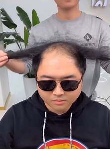 Incredible new hair technology 2021 edition | Emergency!