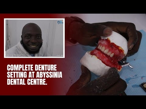 Step-by-Step Guide to Complete Denture Setting Procedure