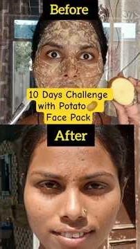 Sun Tanning, Dark Spots, Pigmentation Try This Face Pack 😱✅ #skincare