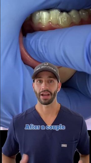 Invisalign Pain: Will it hurt, and is it better or worse than braces?