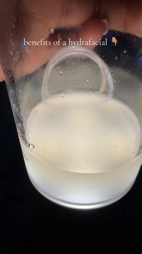 What you’re seeing in that jar? That’s what was sitting in her pores. Hydrafacial uses a patented vortex technology to deeply cleanse, exfoliate, and extract impurities from the skin while simultaneously infusing hydration and treatment serums. Unlike traditional extractions that can be aggressive or irritating, this process is gentle, controlled, and incredibly effective. For clients with congestion, blackheads, or non-inflamed acne, it works like a reset button for the skin clearing out buildu