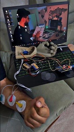 EMG Controlled Robotic Arm for Arduino EMG Sensor, DIY Kit for School Science Education, STEM