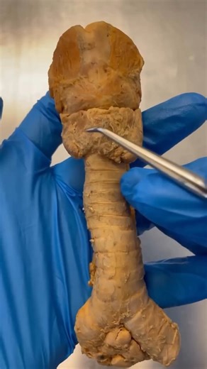 Schoolof Biology on Instagram: "Agar aap apne neck ka ye organ remove kar dein!? . Credit @ioha_hindi 👈 Follow for more content 🙏"