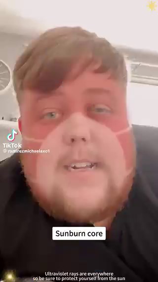 I would urge black people to use SPF as they still can and do get sunburnt and get skin cancer.Black men have the highest fatality rate of skin cancer compared to every other male ethnic group as Melanoma is usually diagnosed at advanced stages.