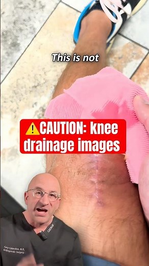 Top 5 Causes of Knee Swelling in Adults