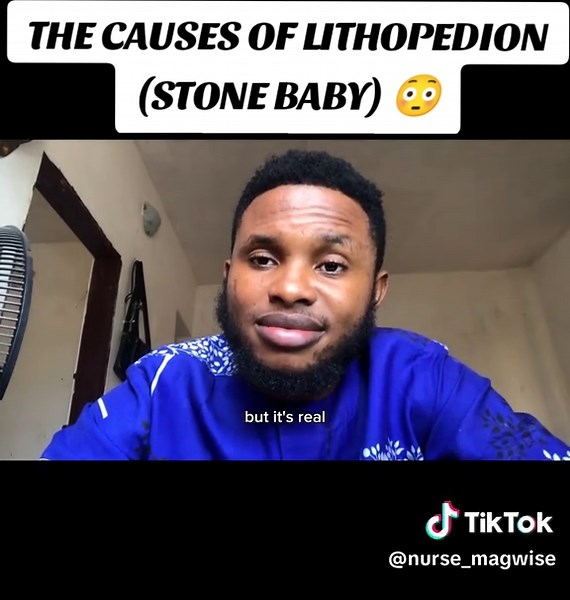 Understanding Stone Baby: Causes and Insights