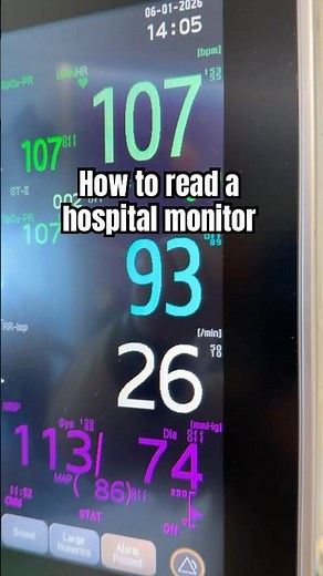 How to Read a Hospital Patient Monitor