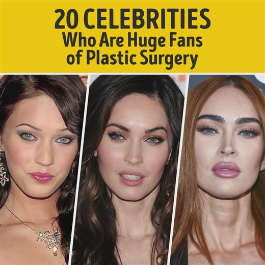 35 Celebrities Who Are Huge Fans of Plastic Surgeries | Bright Side