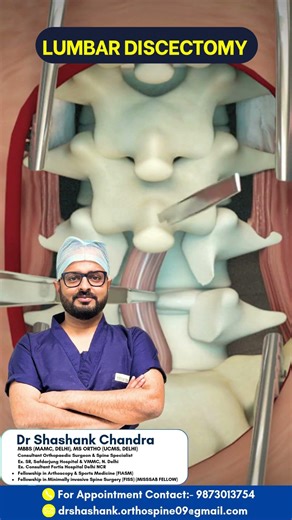 🩺 Lumbar Discectomy – Relief from back and leg pain, faster recovery, better mobility!