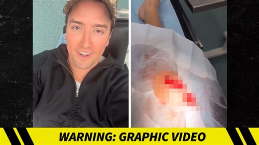 Big Time Rush's Logan Rushed to Hospital After Slicing Open Knee Onstage