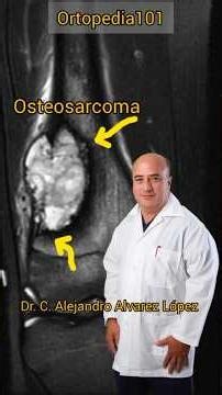 Osteosarcoma #medico #doctor #greenscreen