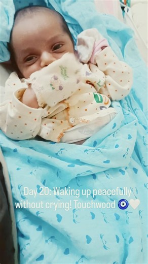 Waking up peacefully! (20 Days Old) Touchwood 🧿 #shorts
