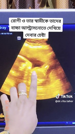 Understanding Ultrasound Images: A Detailed Exploration