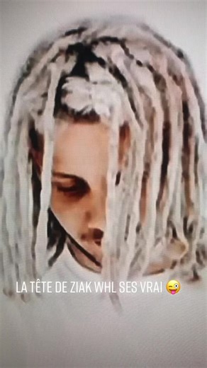 La tête de ziak #pourtoi
